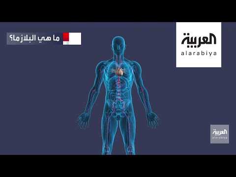 لايف ستايلشاهد: جدل بين خبراء الصحة العالميين حول نجاعة بلازما الدم في علاج "كورونا"190507/0