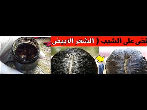 خلطة سرية تقضي على الشيب نهائيًا