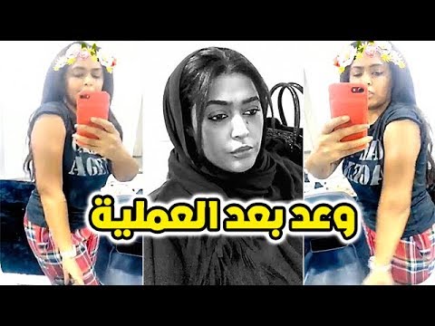 شاهد الفنانة وعد تجري عملية في يدها