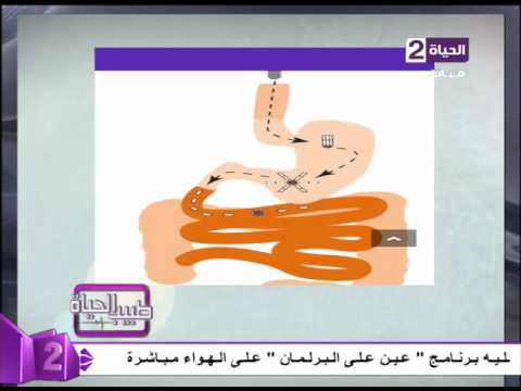 طفرة جديدة في مجال الطب لمرضى السكر والضغط