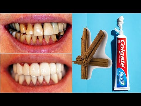 وصفة بسيطة لتبيض الأسنان بشكل سريع
